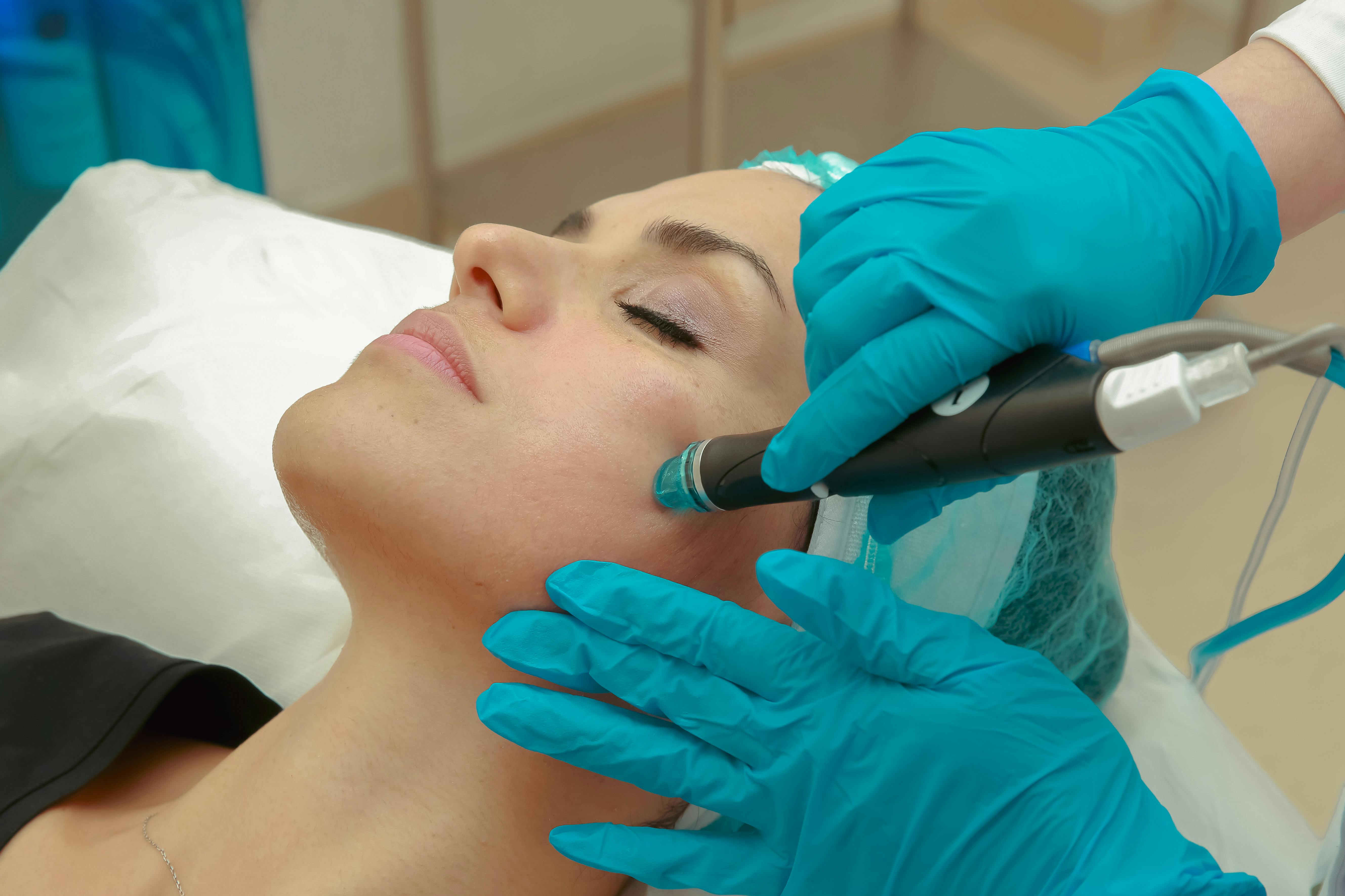 VI Peel Nyack: A Powerful Option for Smoother, Brighter Skin